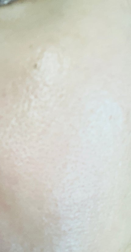 アビブ グルタチオンソームダークスポットセラムビタドロップ/Abib /美容液を使ったクチコミ(7枚目)