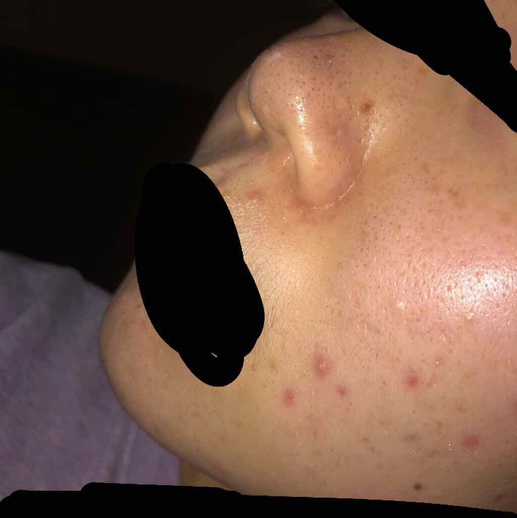 ホホバオイル/無印良品/ボディオイルを使ったクチコミ（3枚目）