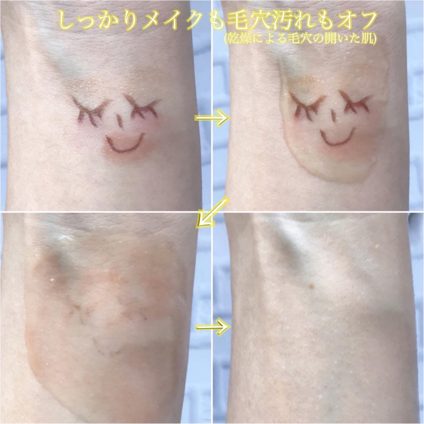 ダブルリペア ツートン セラム/ドットフォース/美容液を使ったクチコミ(4枚目)