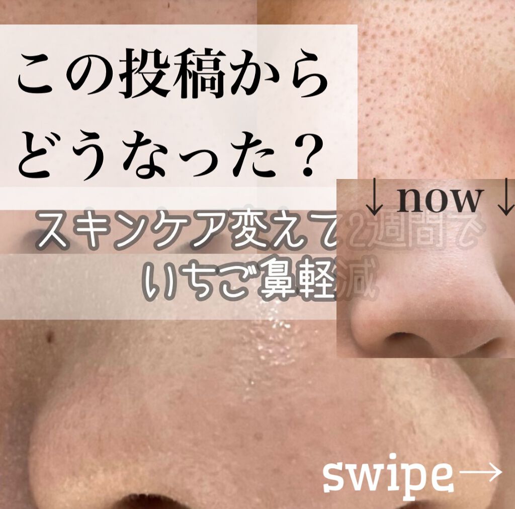 ïŒæ§ïŒã¢ã«ãã£ã 8â ã¹ããªã ãã¥ãŒã㣠ã¯ã¬ã³ãžã³ã° ãªã€ã«/shu uemura/ãªã€ã«ã¯ã¬ã³ãžã³ã°ã䜿ã£ãã¯ãã³ãïŒ1æç®ïŒ