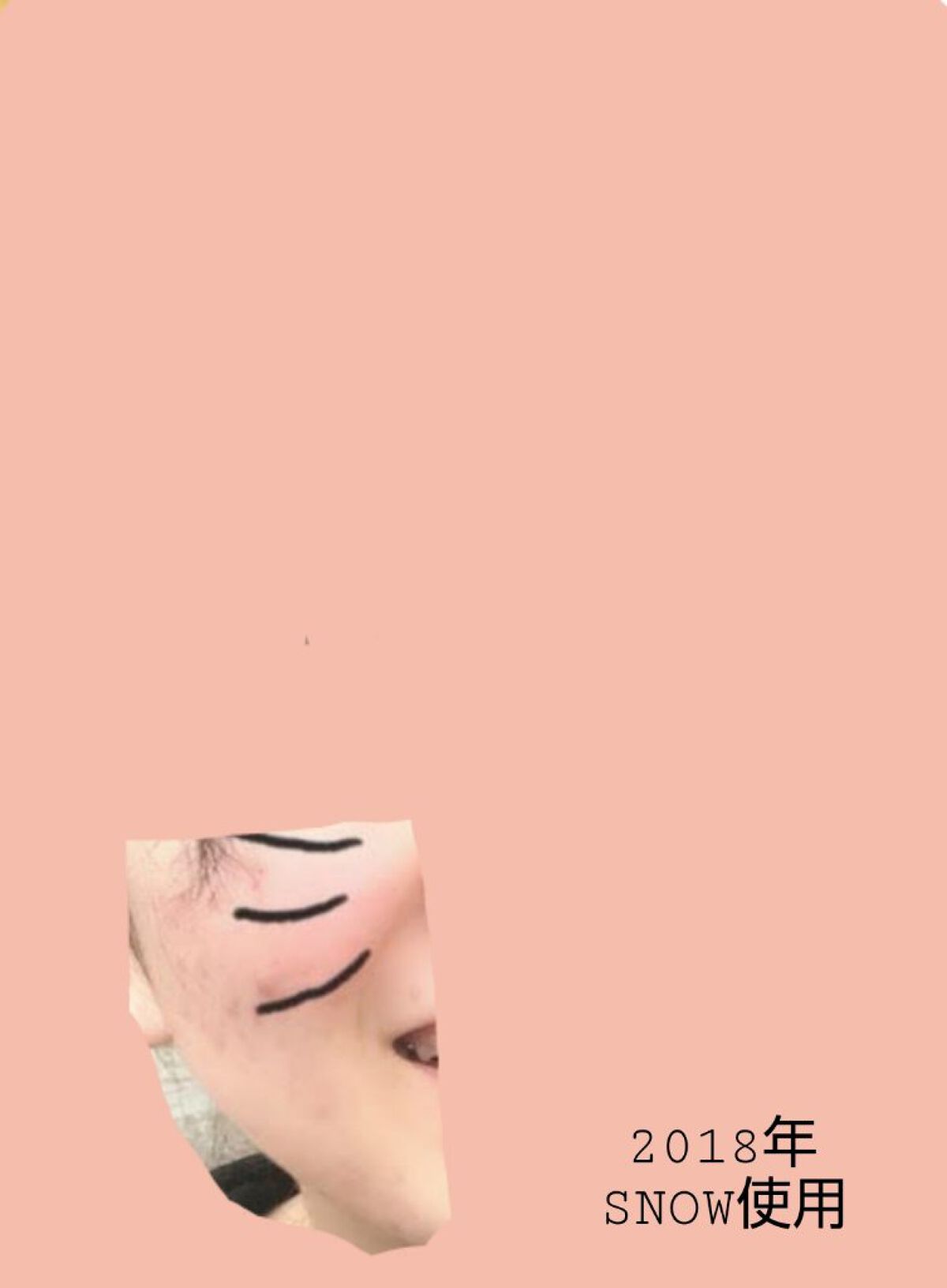 スマートセット/プロアクティブ/スキンケアキットを使ったクチコミ（1枚目）