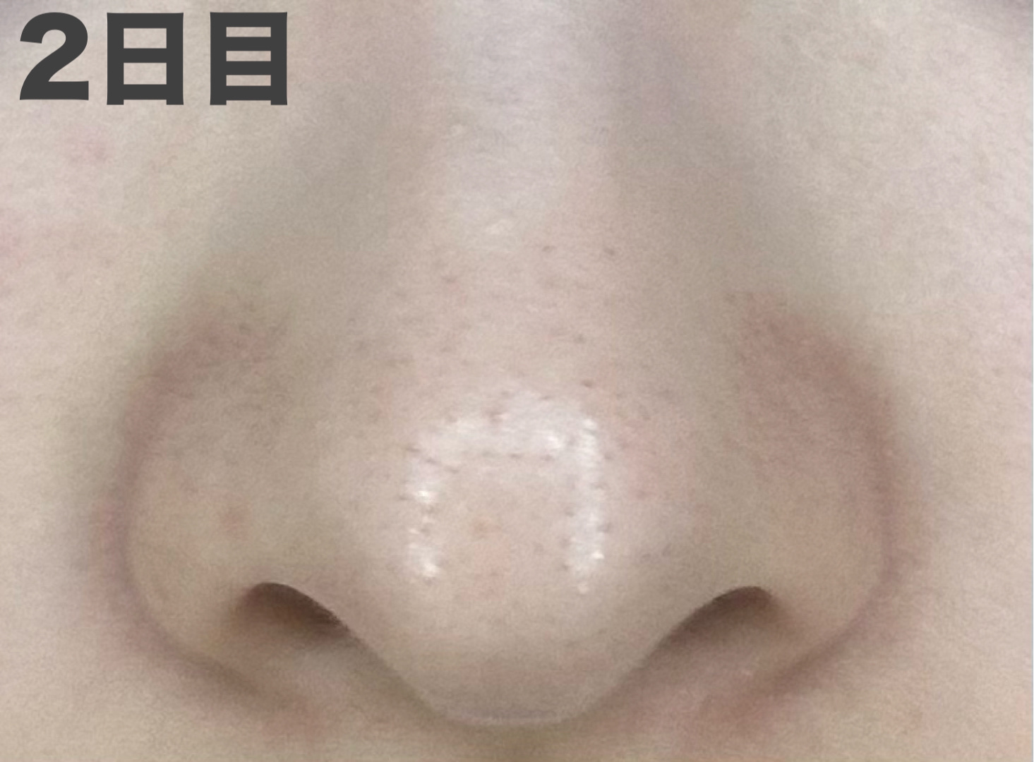 パーフェクトワンフォーカス スムースクレンジングバーム ディープブラック クロミ 限定デザイン（75g）/PERFECT ONE  FOCUS/クレンジングバームを使ったクチコミ（3枚目）