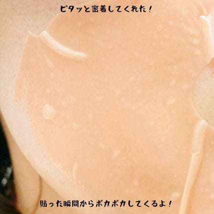 マスクフォンデュ/Quanis/シートマスク・パックを使ったクチコミ(5枚目)