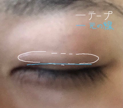 二重まぶた用シール/DAISO/二重まぶた用アイテムを使ったクチコミ(3枚目)