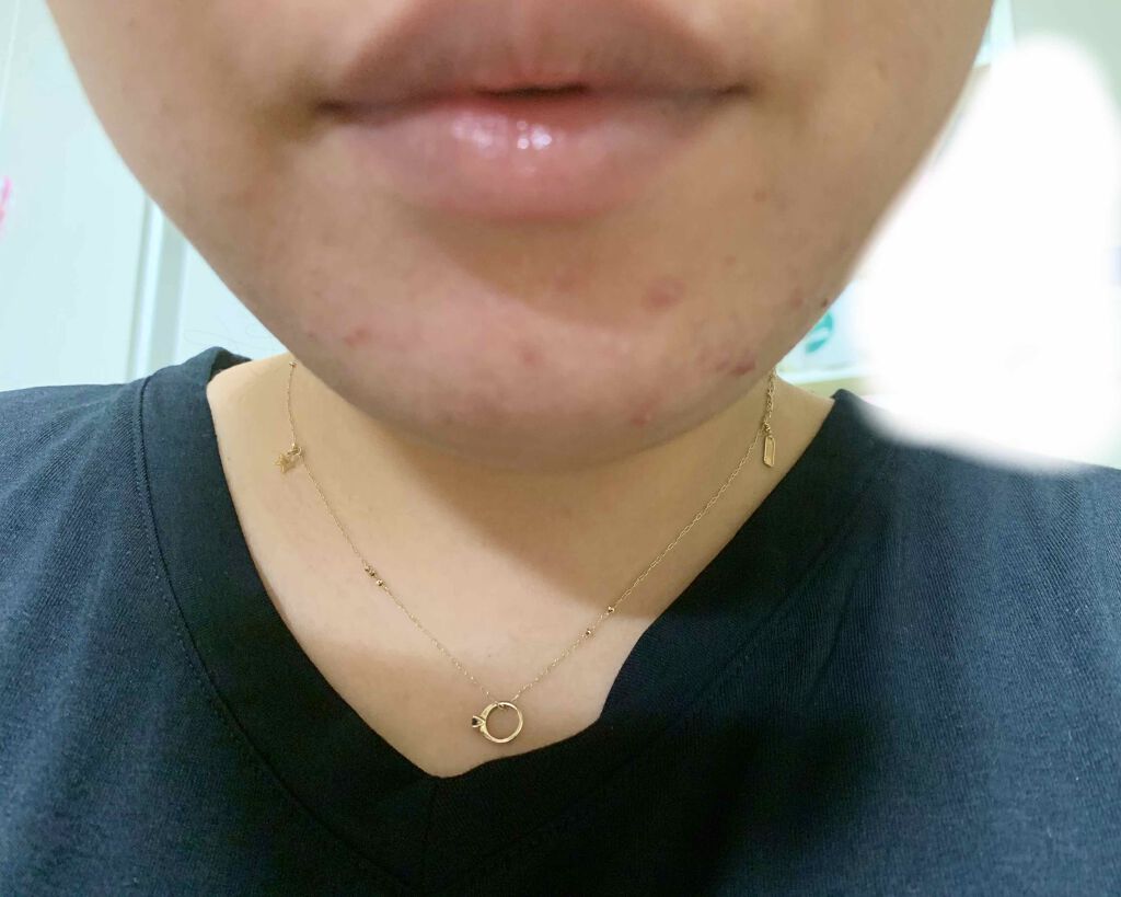 マンデリック インテンシブ 18%セラム/DR.WU/美容液を使ったクチコミ（2枚目）