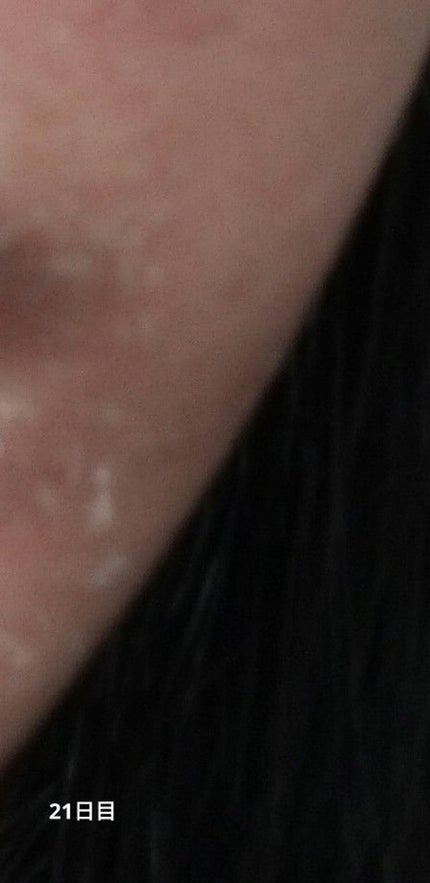 ミラミックス/ZO Skin Health/フェイスクリームを使ったクチコミ(4枚目)