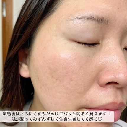 ビタタイガーマスク/NOWATER/シートマスク・パックを使ったクチコミ(8枚目)