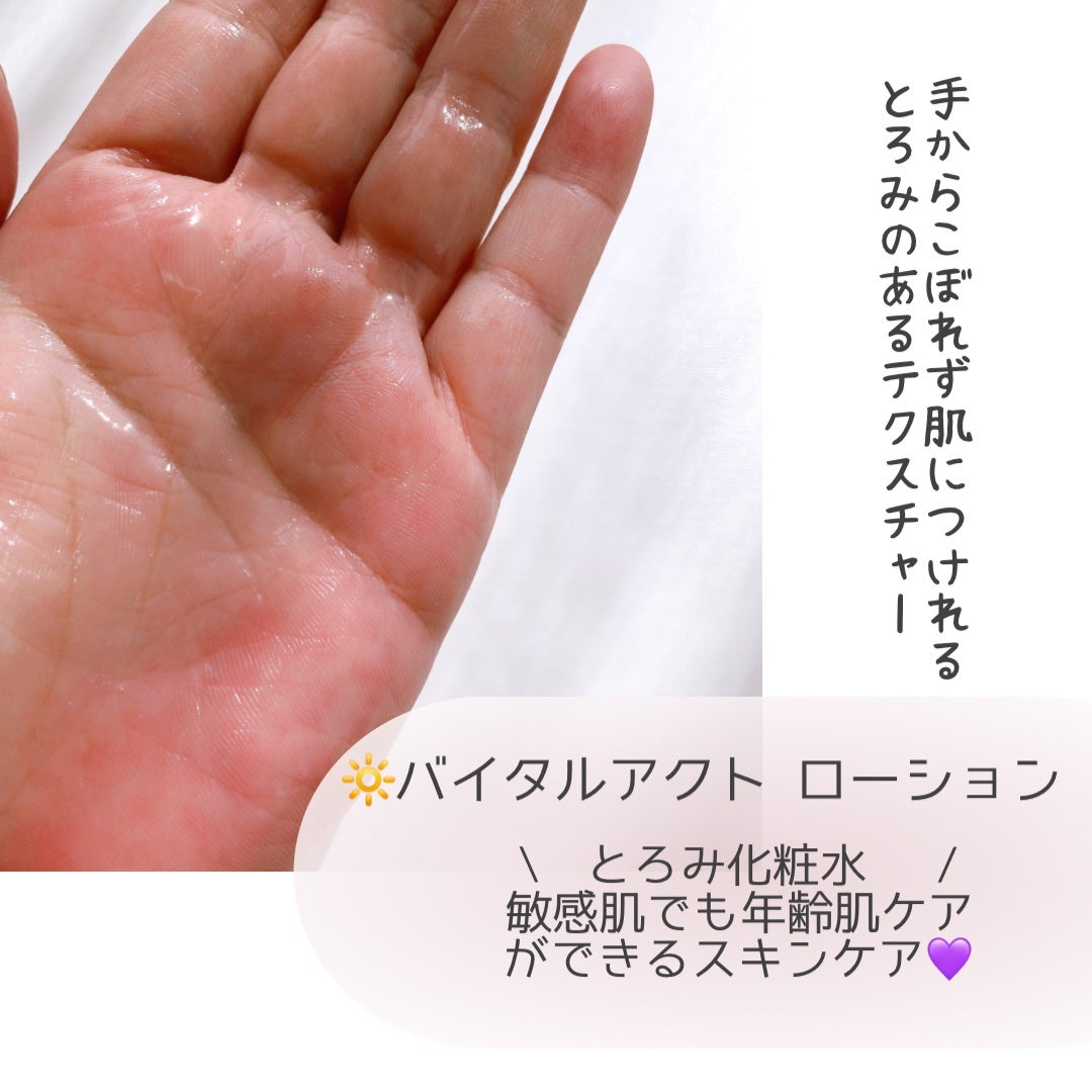 バイタルアクト ローション MB/d プログラム/化粧水を使ったクチコミ(2枚目)