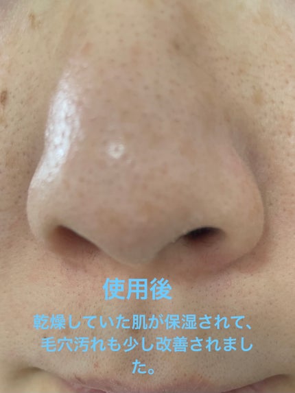 角質スッキリ毛穴パック /HANYUL(ハンユル)/洗い流すパック・マスクを使ったクチコミ(5枚目)