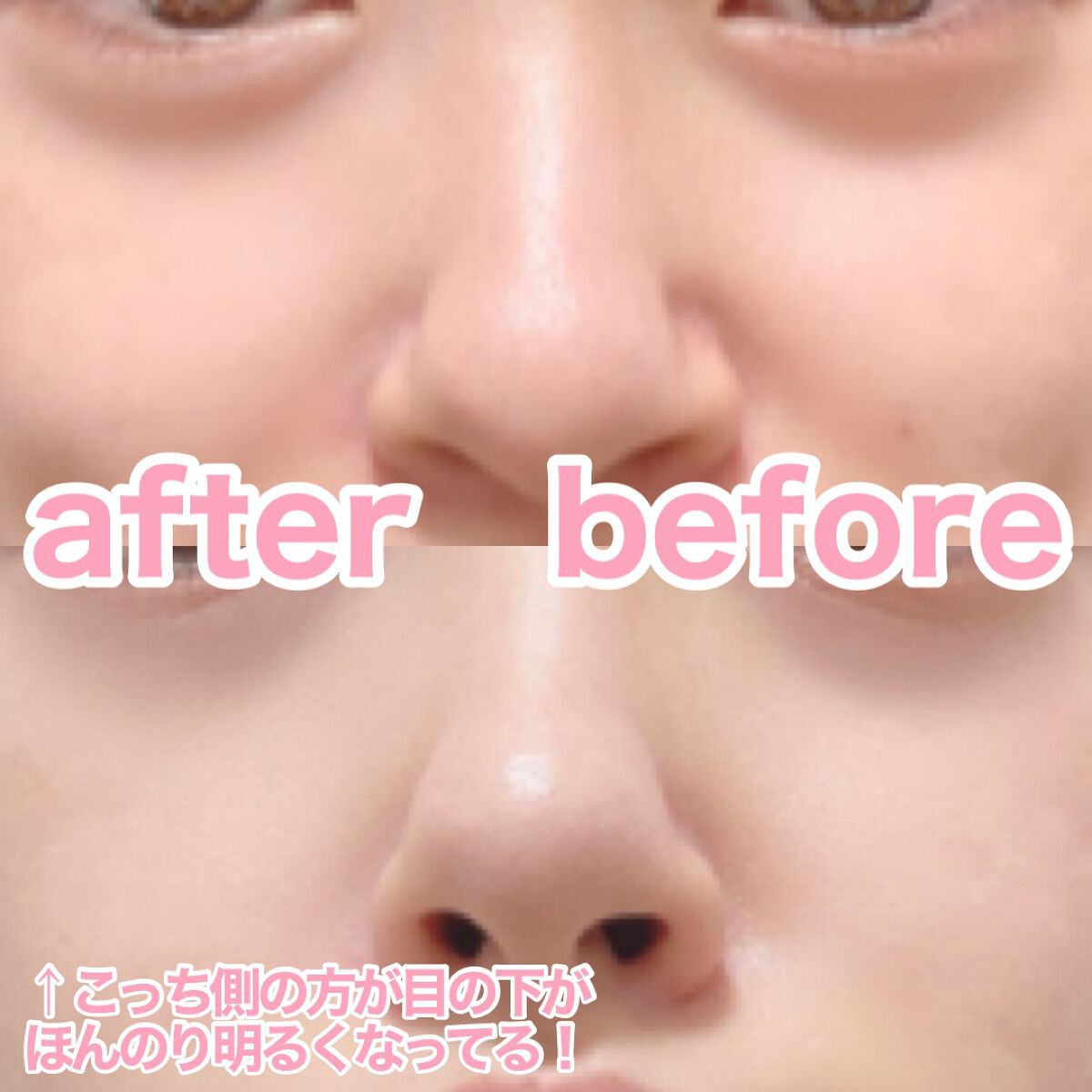 スムースアイコンシーラー/aZTK/クリームコンシーラーを使ったクチコミ(6枚目)