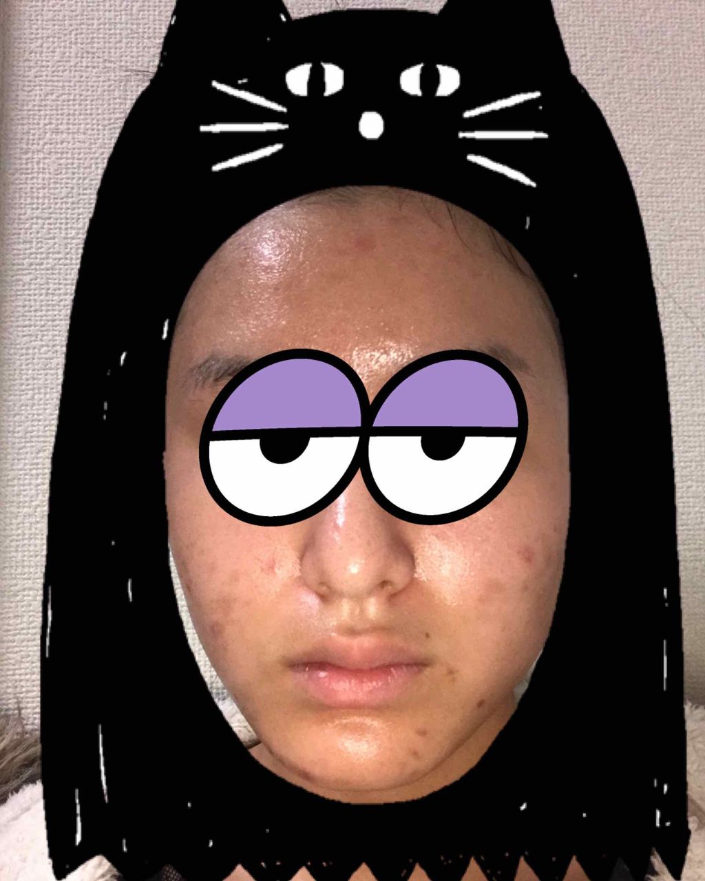 明色美顔水 薬用化粧水/美顔/化粧水を使ったクチコミ（2枚目）