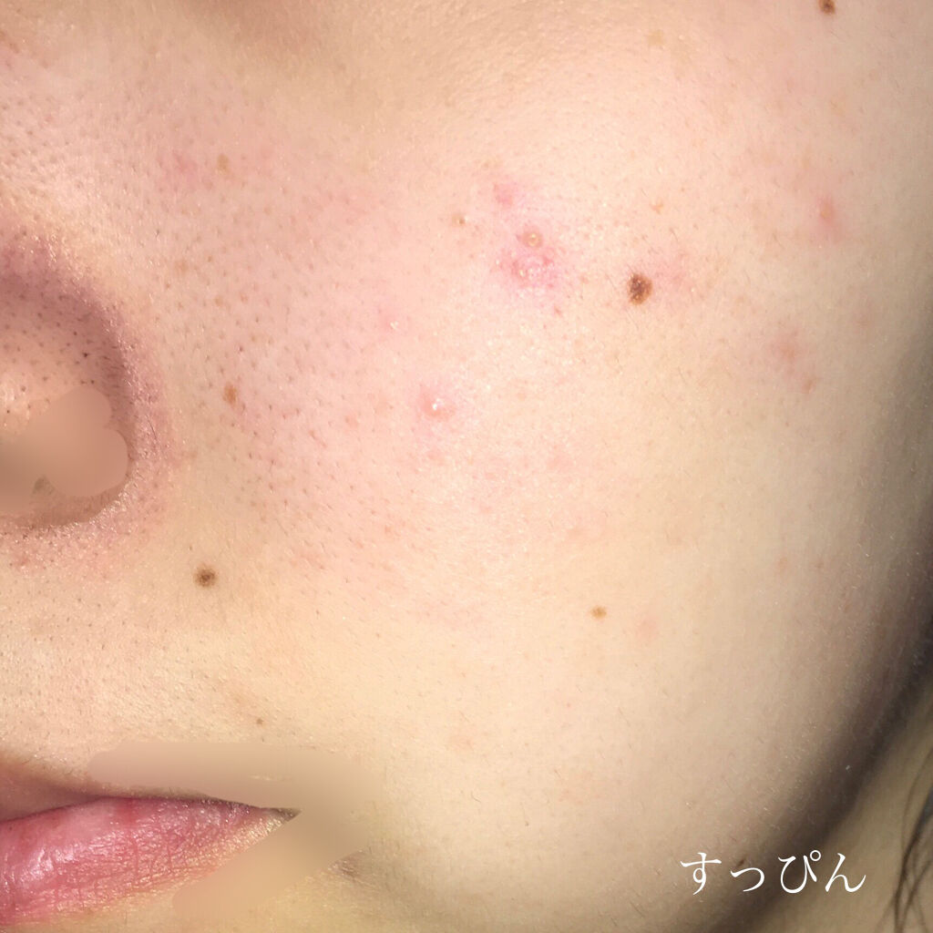 ダーマグッドグリーンクッション 21号/VELY VELY/クッションファンデーションを使ったクチコミ（2枚目）