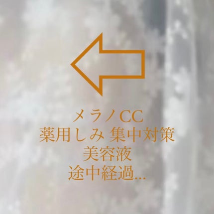 薬用 しみ 集中対策 美容液/メラノCC/美容液を使ったクチコミ(1枚目)