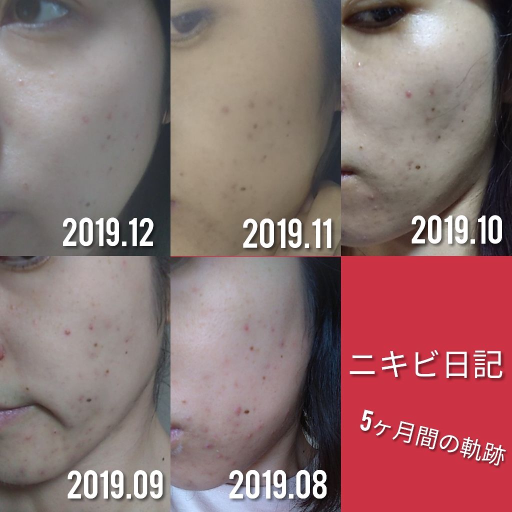 敏感肌用薬用美白美容液/無印良品/美容液を使ったクチコミ（3枚目）