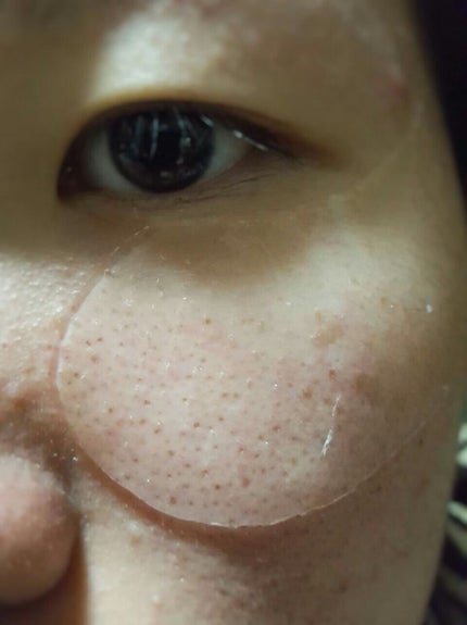 ハイドロゲル アイパッチ アルティメイト/+OneC(プラワンシー)/アイケア・アイクリームを使ったクチコミ(3枚目)