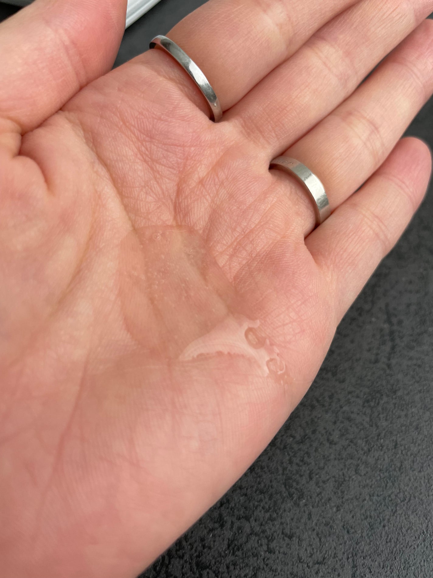 フィトジェン 弱酸性 バランス ジェル クレンザー/Anestee/洗顔フォームを使ったクチコミ(2枚目)