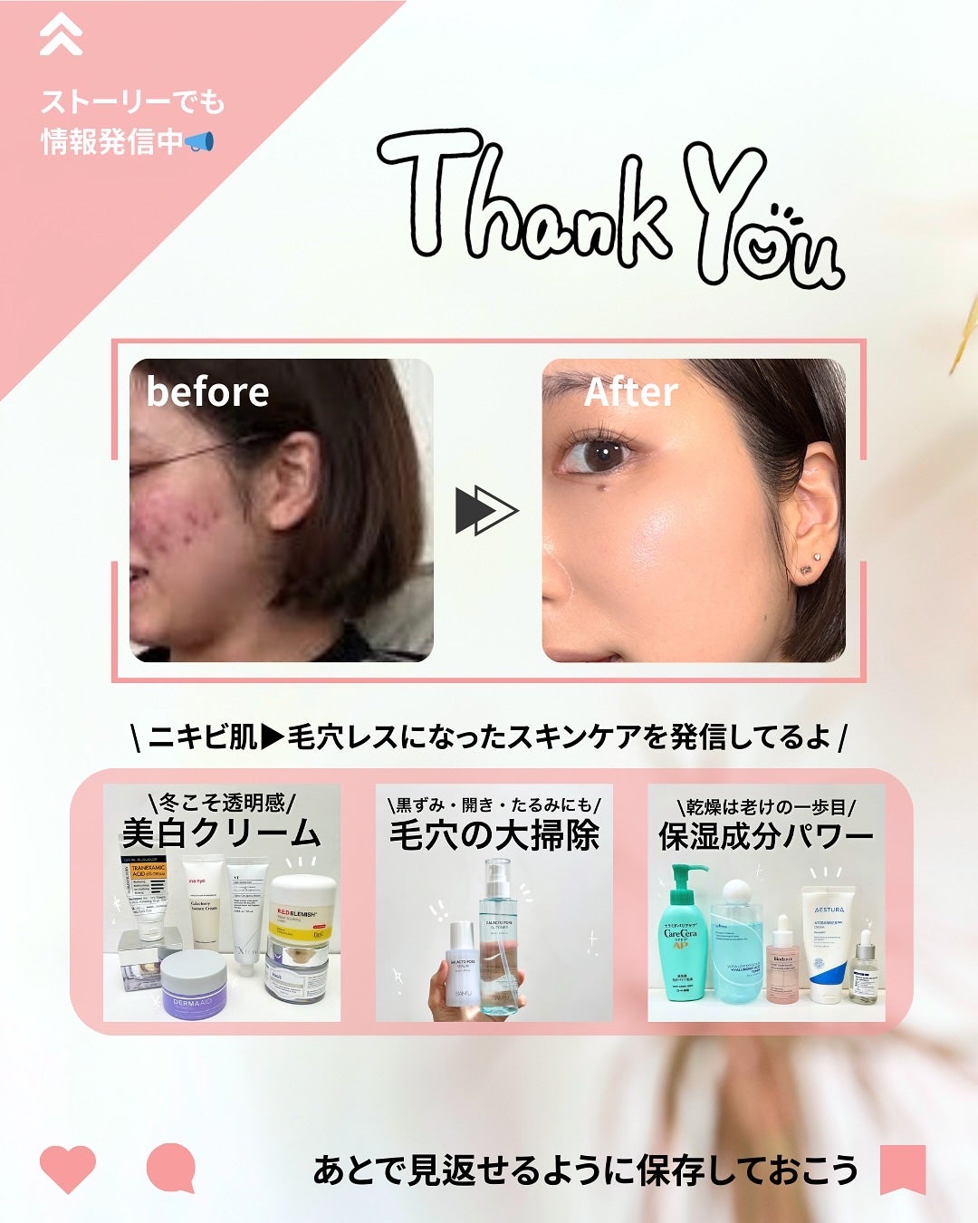 なぎ | スキンケア薬剤師 on LIPS 「◀︎ニキビ肌から毛穴レスになった薬剤師ニキビできたらこれやって..」(9枚目)