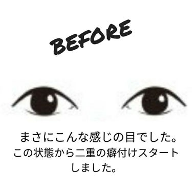 ワンダーアイリッドテープ ポイント N/D-UP/二重まぶた用アイテムを使ったクチコミ（2枚目）