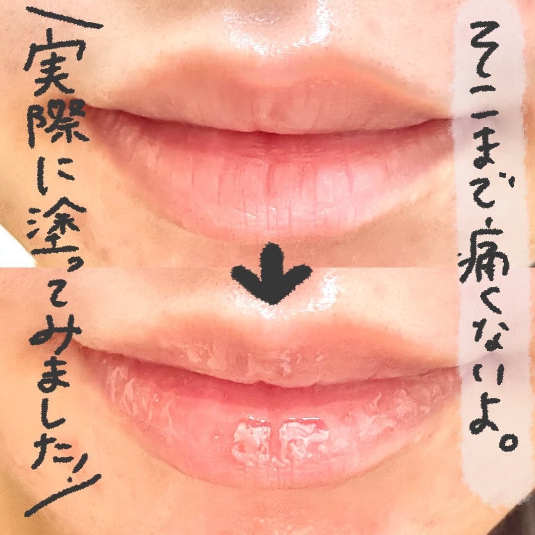 ラシャスリップス/ラシャスリップス/リップグロスを使ったクチコミ(4枚目)