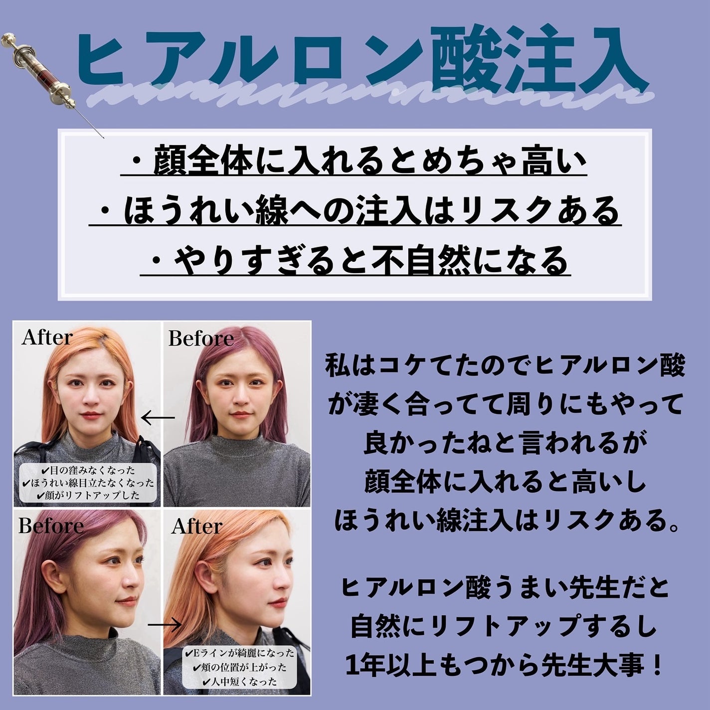 とみりー on LIPS 「美容医療デメリット詳細↓過去にやってきた美容医療のメリットは..」(5枚目)