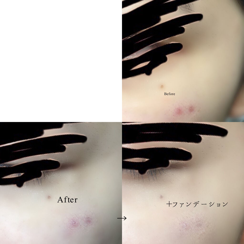 ドクタージャルト シカペア リカバー (第2世代)/Dr.Jart+/フェイスクリームを使ったクチコミ(3枚目)