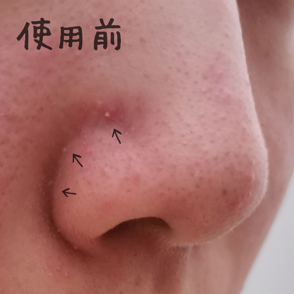 ベビーオイル ナチュラル/DAISO/ボディオイルを使ったクチコミ(3枚目)