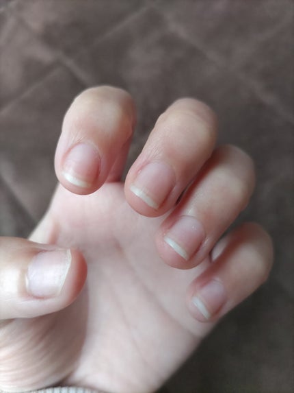 ジェルボリュームトップコート/キャンメイク/ネイルトップコートを使ったクチコミ(6枚目)