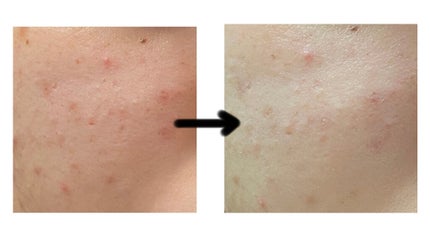 スムースカラーベース/毛穴パテ職人/化粧下地を使ったクチコミ(2枚目)