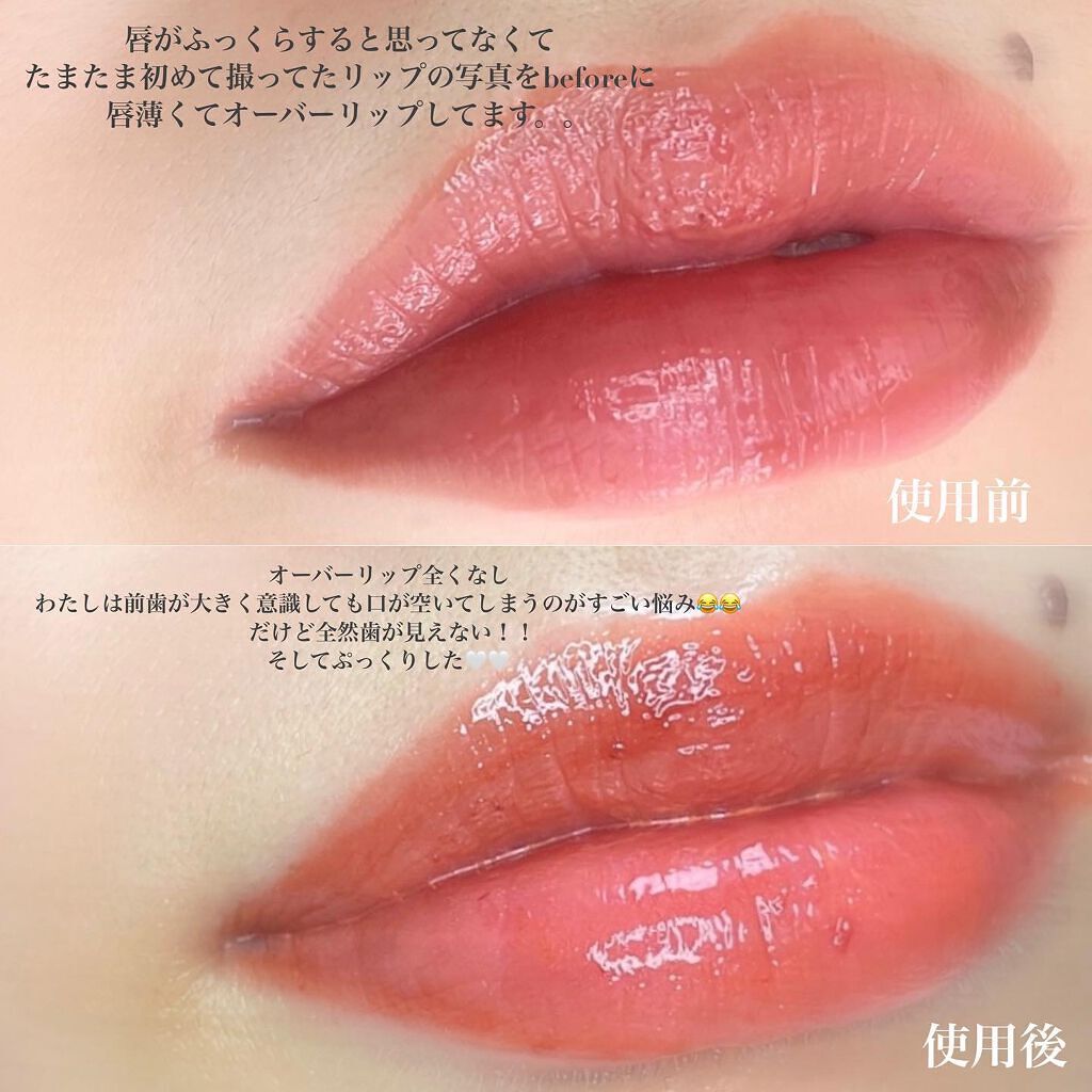 メディリフト 3Dマイクロフィラー(口元用)/YA-MAN TOKYO JAPAN/シートマスク・パックを使ったクチコミ(9枚目)