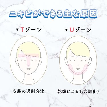 公式 ナリスアップ On Lips Tゾーンとuゾーンのニキビの違いって Tゾーン皮脂の過剰分泌 Lips