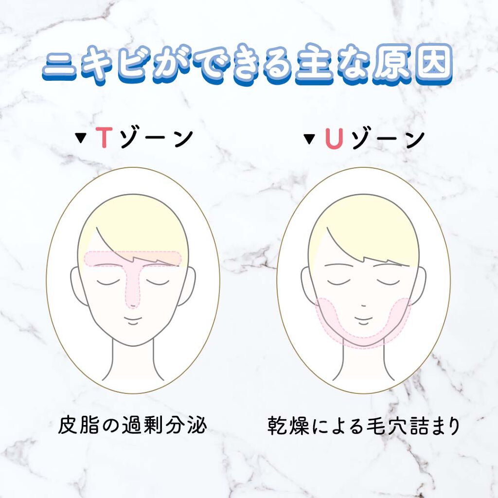 公式 ナリスアップ On Lips Tゾーンとuゾーンのニキビの違いって Tゾーン皮脂の過剰分泌 Lips