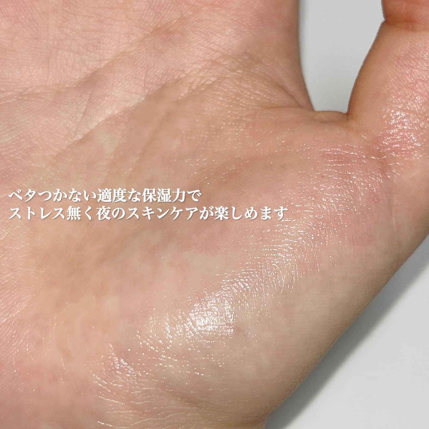 シカレチA クリーム0.05/VT/フェイスクリームを使ったクチコミ(5枚目)