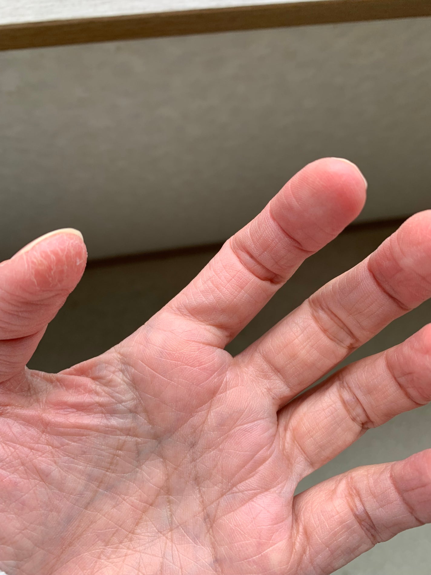 コーワ20%尿素配合クリーム(医薬品)/ケラチナミン/その他を使ったクチコミ(3枚目)