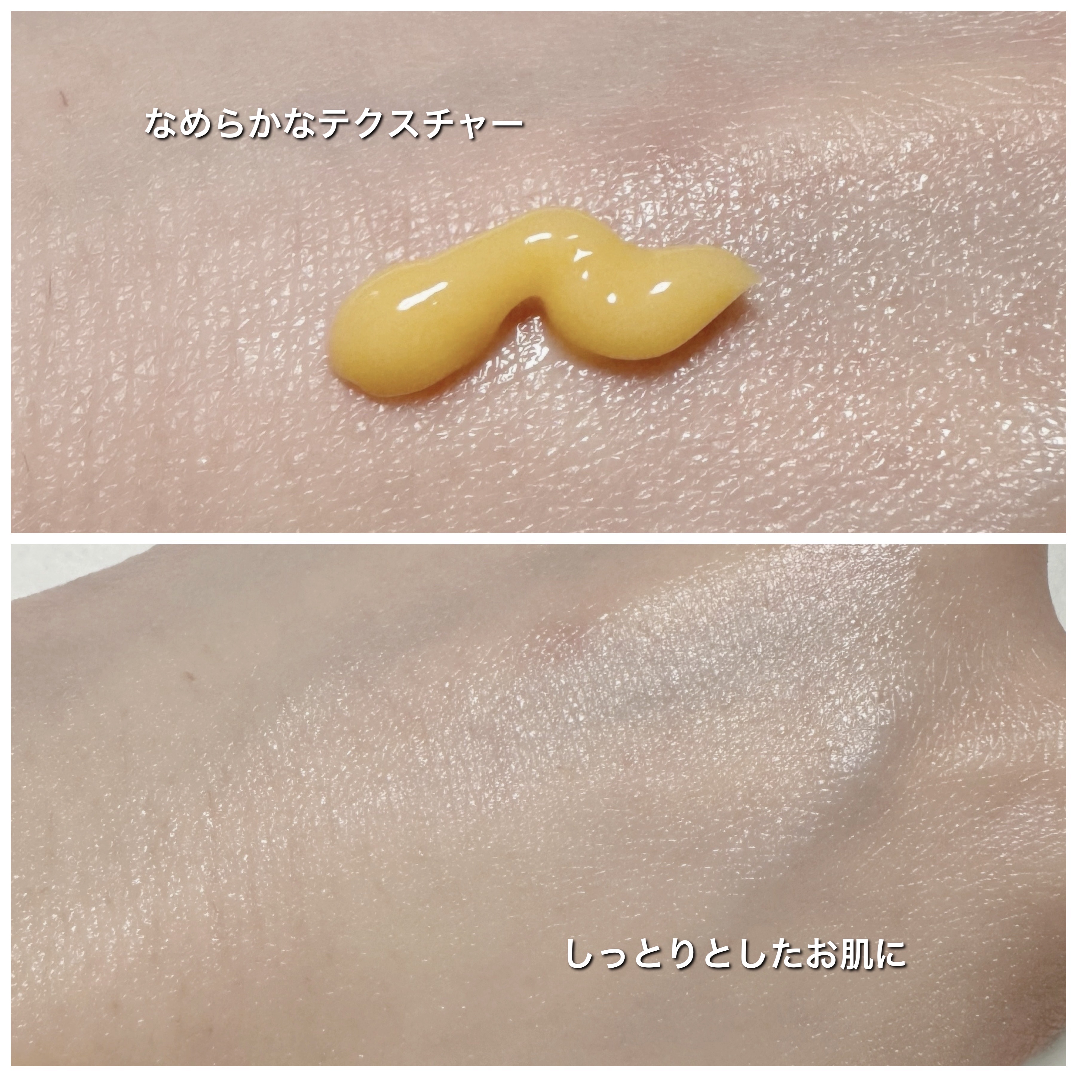 トラネキサム酸6％クリーム/DERMA FACTORY/フェイスクリームを使ったクチコミ（3枚目）
