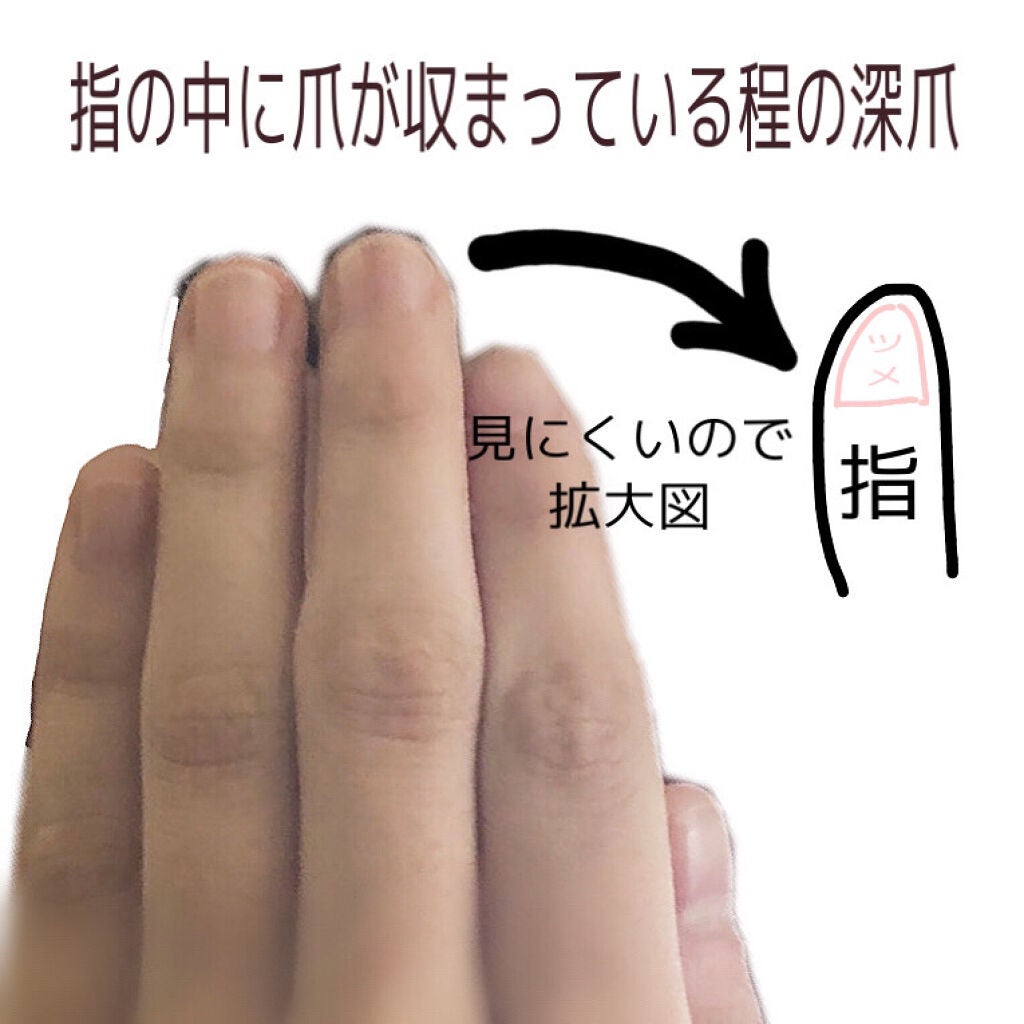 ネイルエンビー/O・P・I/ネイルオイル・トリートメントを使ったクチコミ(3枚目)