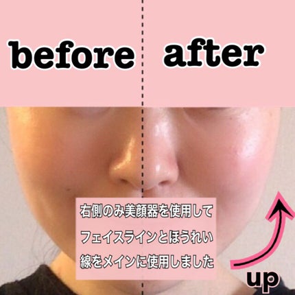 イオン導入美顔器フォトマックス /ar&ar /美顔器・マッサージを使ったクチコミ(7枚目)