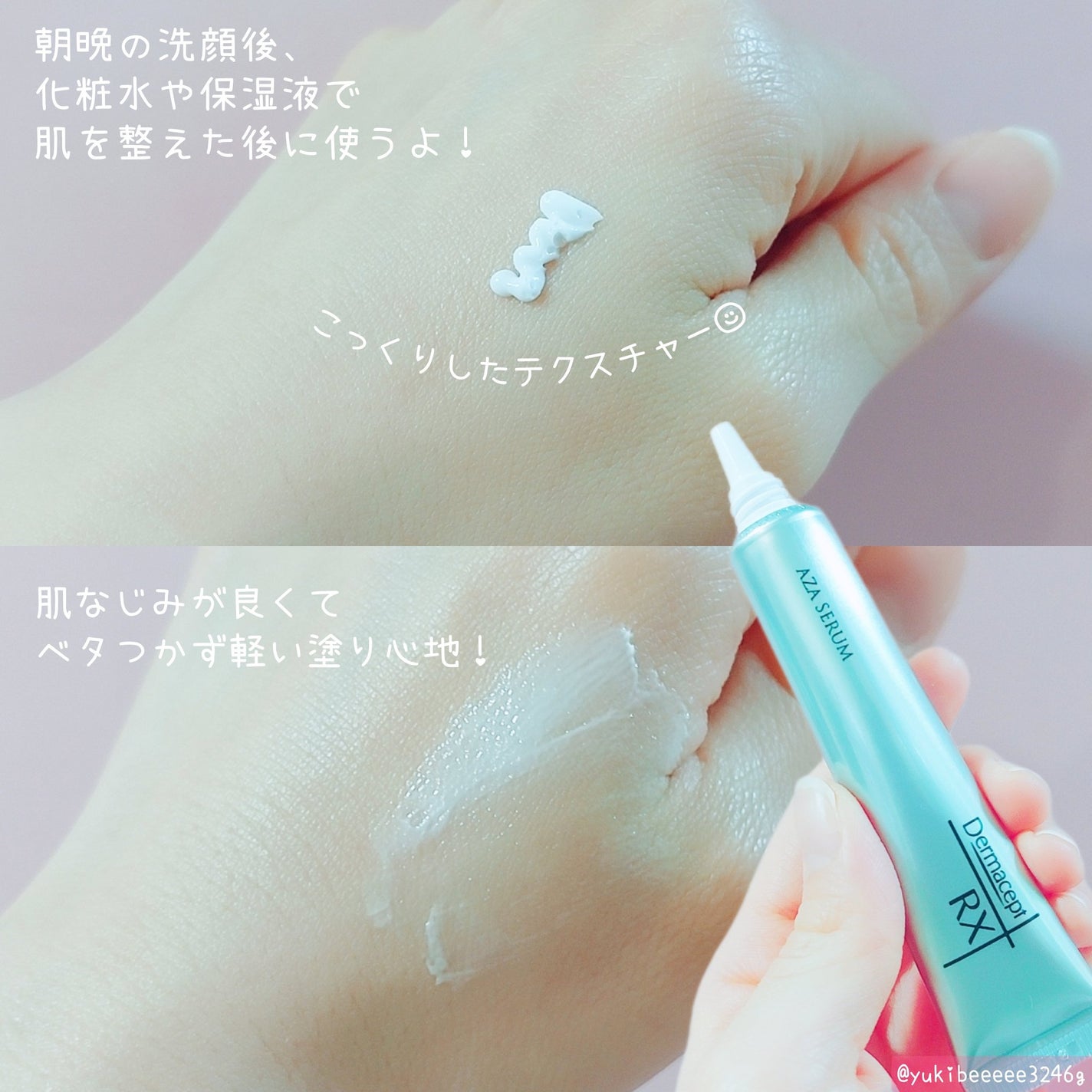 ダーマセプトRX AZAセラム/ダーマセプトRX/美容液を使ったクチコミ(2枚目)
