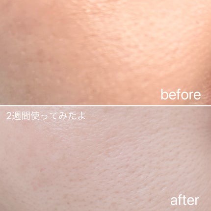 リードルショット300/VT/美容液を使ったクチコミ(8枚目)