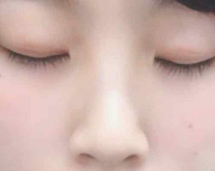 アイテープ片面(のびる)絆創膏タイプ スリム 120枚/セリア/二重まぶた用アイテムを使ったクチコミ(3枚目)