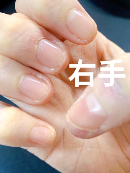 ネイルサポート Na/ネイルネイル/ネイルトップコートを使ったクチコミ(3枚目)