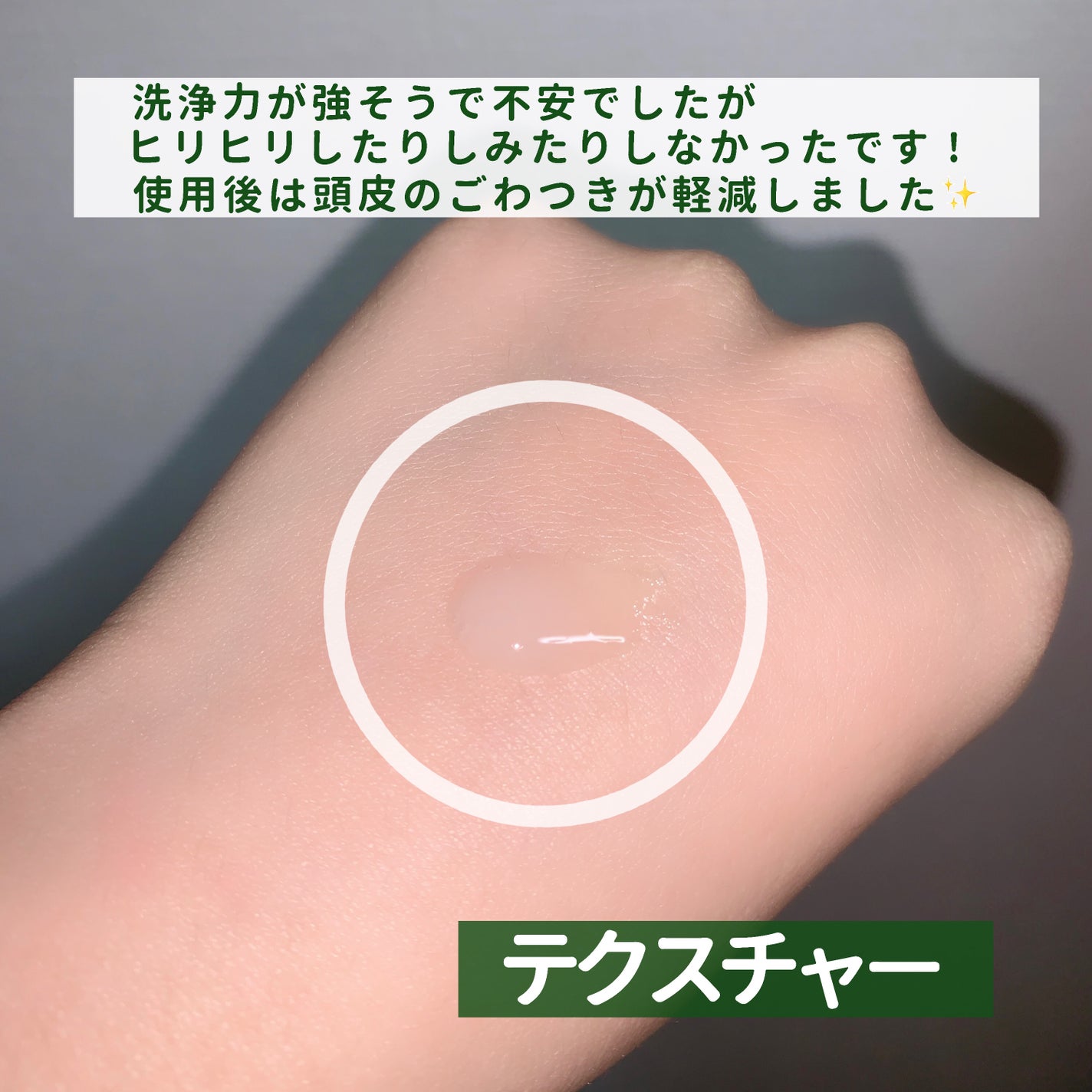 スパークリングスカルプスケーラー/ミンツリー/頭皮ケアを使ったクチコミ(3枚目)