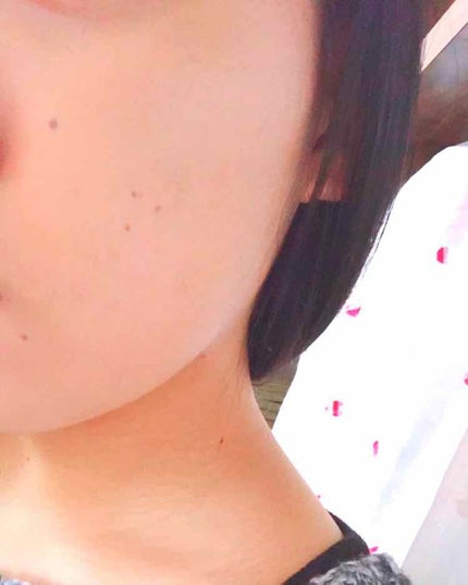 スポッツカバー ファウンデイション/SHISEIDO/クリームコンシーラーを使ったクチコミ(3枚目)