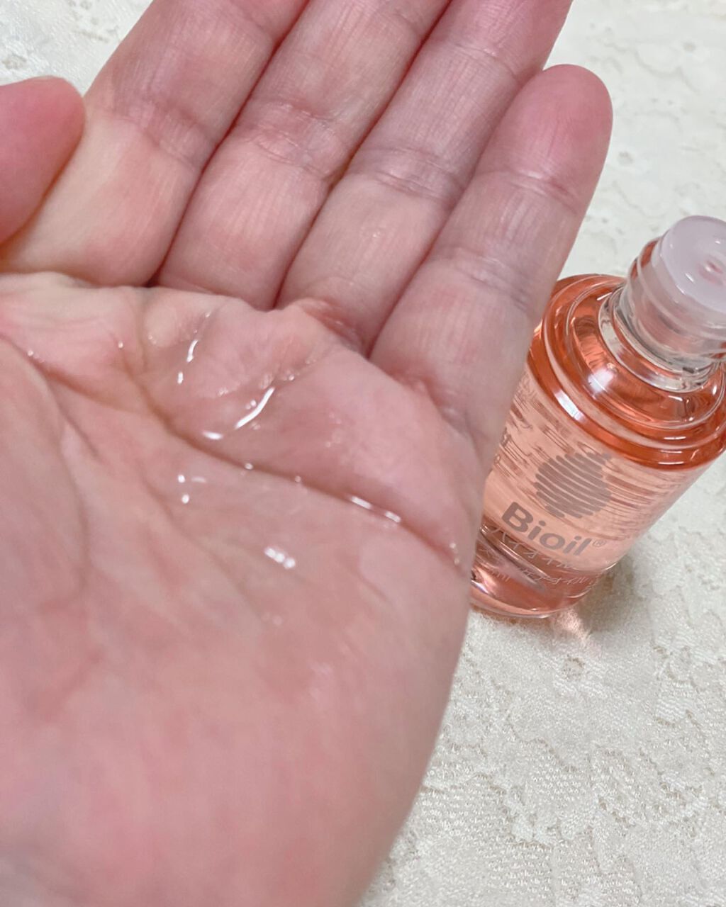 バイオイル/バイオイル/フェイスオイルを使ったクチコミ(2枚目)