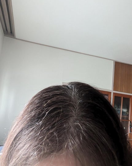 miki-nu on LIPS 「90日体験結果発表~♪紫外線も強烈高温多湿のジメジメ頭皮の髪悩..」(3枚目)