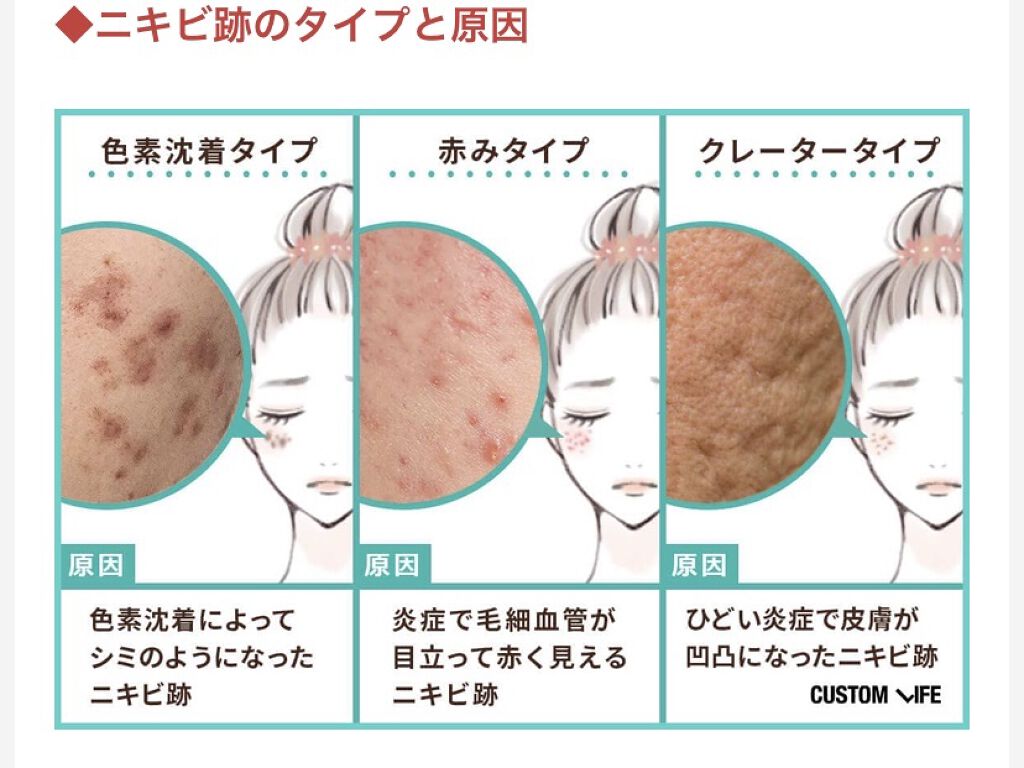 バランシングライントラベルセット/エトヴォス/トライアルキットを使ったクチコミ（2枚目）