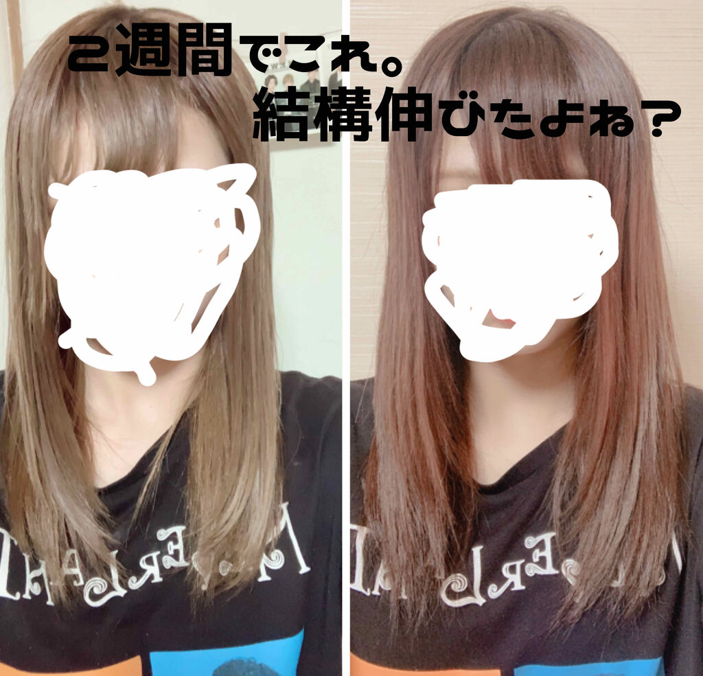 DHC 亜鉛/DHC/健康サプリメントを使ったクチコミ（1枚目）