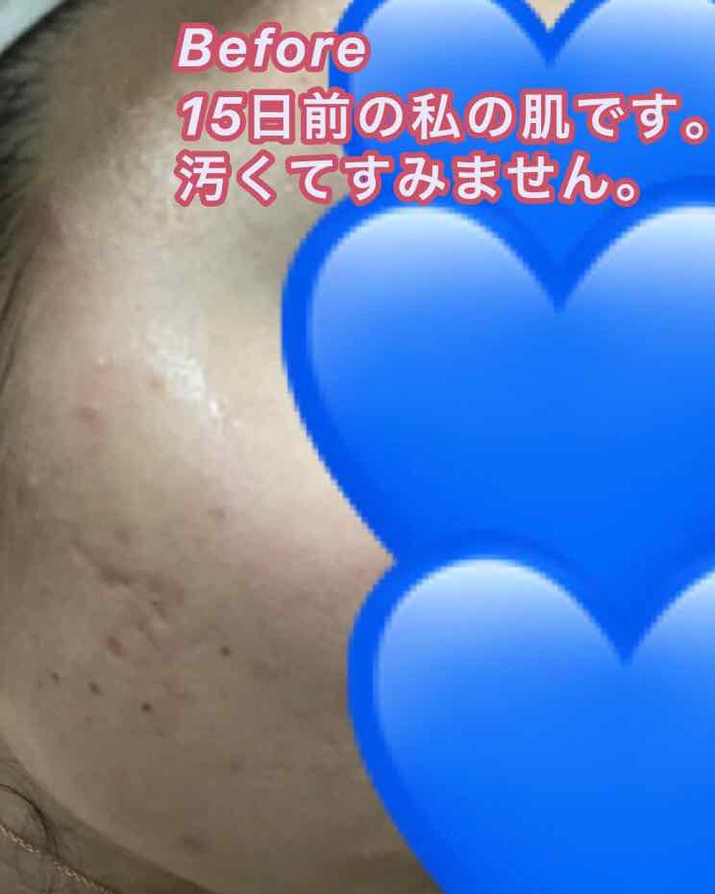 ティーツリーケア ソリューション エッセンシャルマスクEX/MEDIHEAL/シートマスク・パックを使ったクチコミ（3枚目）