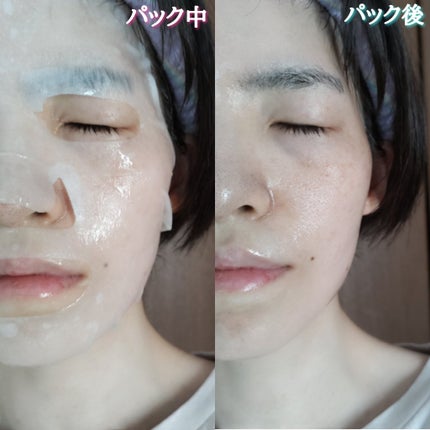 マリンルミナスモイスチャーマスクプラスアルファ/JMsolution/シートマスク・パックを使ったクチコミ(6枚目)