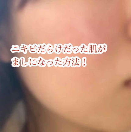 化粧水・敏感肌用・高保湿タイプ/無印良品/化粧水を使ったクチコミ(1枚目)