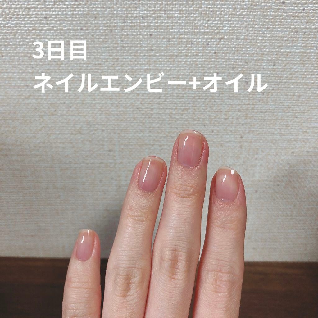 ネイルエンビー/O・P・I/ネイルオイル・トリートメントを使ったクチコミ(5枚目)